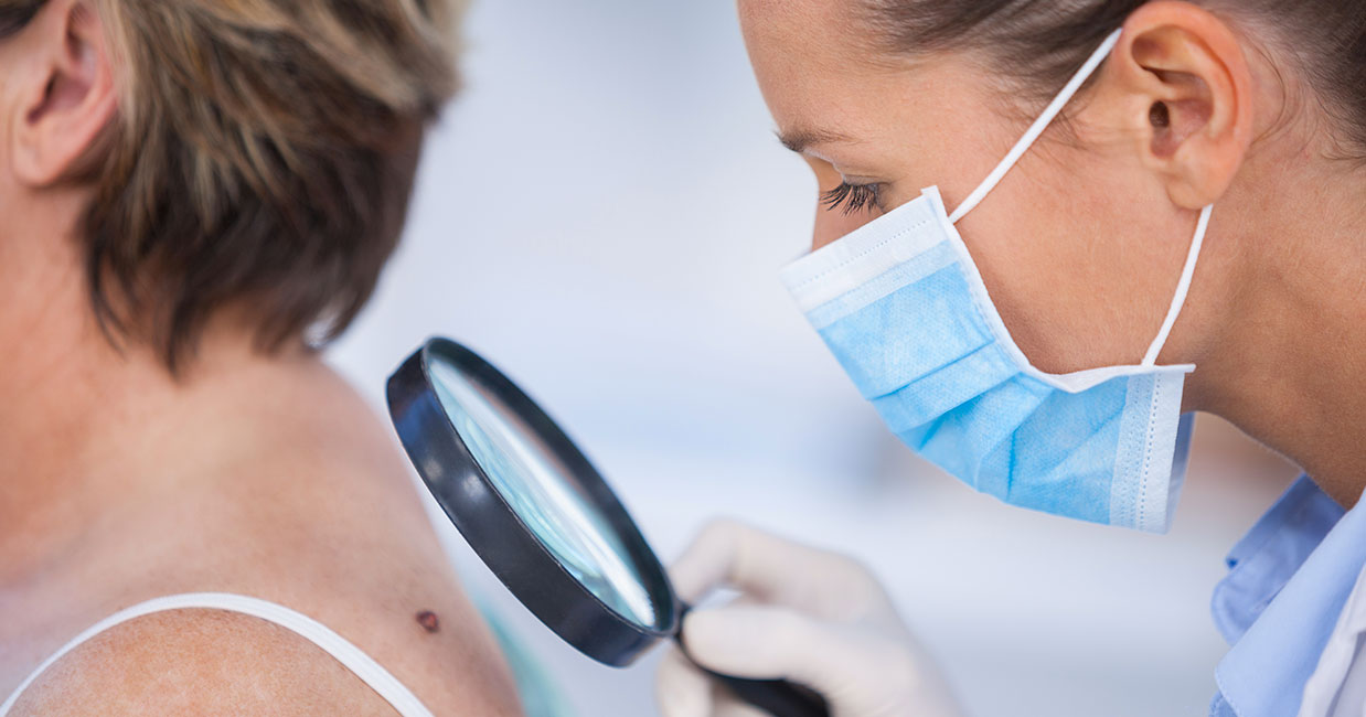 Skin cancer ... how to detect it? | Clinique les Oliviers